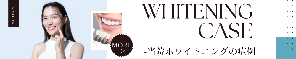 ホワイトニング症例バナー
